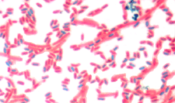 Endospore stain of Bacillus